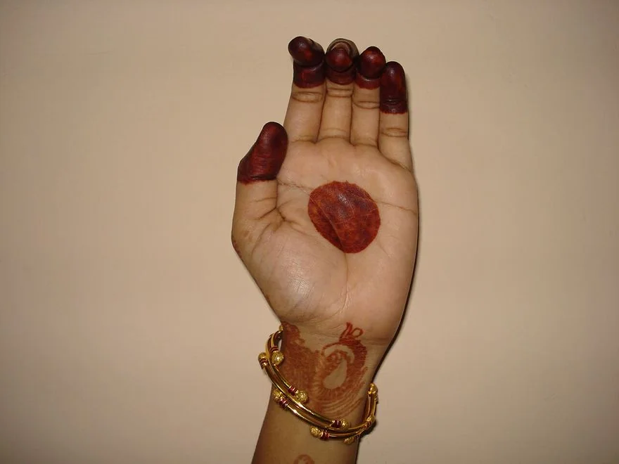 Sarpashirsha — photograph